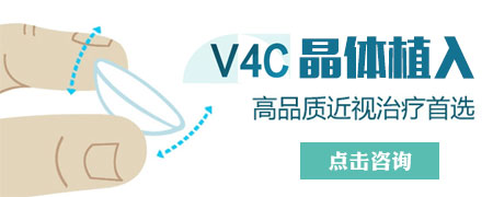 武汉高度近视的新技术V4C