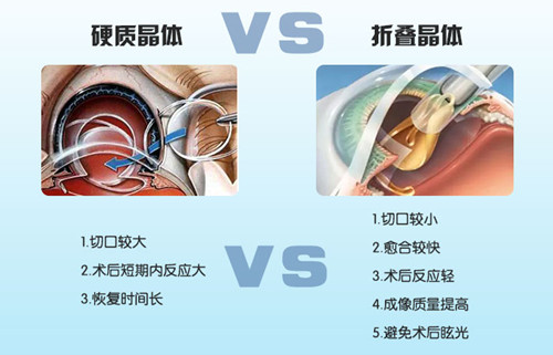 普瑞慈善光明基金爱心升级!白内障手术升级折叠晶体!