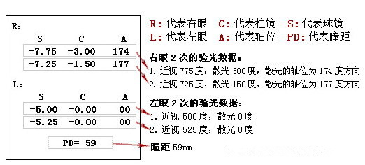 验光单怎么看？上面的SCA是什么意思？