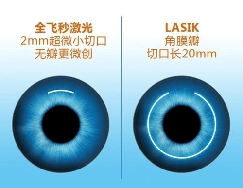 蔡司全飞秒3.0智能升级，优势何在?