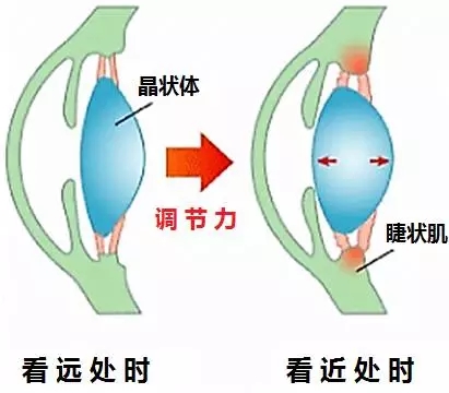 孩子近视了，坐前排好还是后排好？