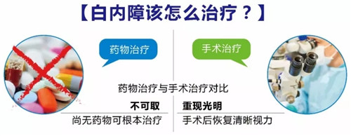 普瑞眼科白内障专家张晓农教授受邀做客《邦华导医》