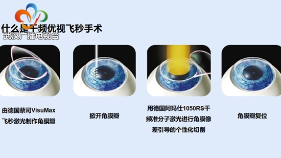 近视手术怎么选?专家提醒优质视觉质量还需“量眼定制”