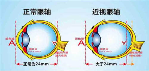 武汉普瑞眼科医院林珊：防控近视要科学，4大误区需谨防