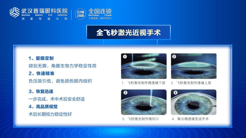 近视一族看过来｜全飞秒or半飞秒，你知道怎么选吗？